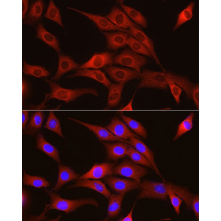 Immunofluorescence - Anti-TRIM4 Antibody (A90582) - Antibodies.com