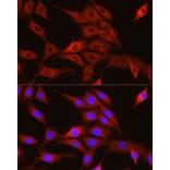 Immunofluorescence - Anti-TRIM4 Antibody (A90582) - Antibodies.com