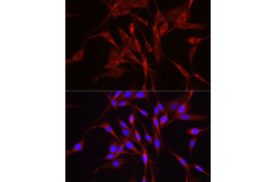 Immunofluorescence - Anti-TRIM4 Antibody (A90582) - Antibodies.com