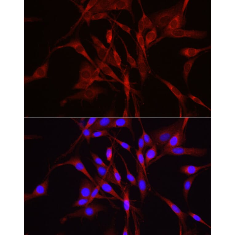 Immunofluorescence - Anti-TRIM4 Antibody (A90582) - Antibodies.com