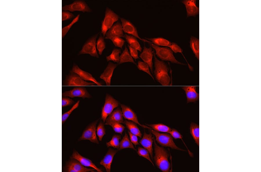 Immunofluorescence - Anti-TRIM4 Antibody (A90582) - Antibodies.com