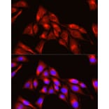 Immunofluorescence - Anti-TRIM4 Antibody (A90582) - Antibodies.com