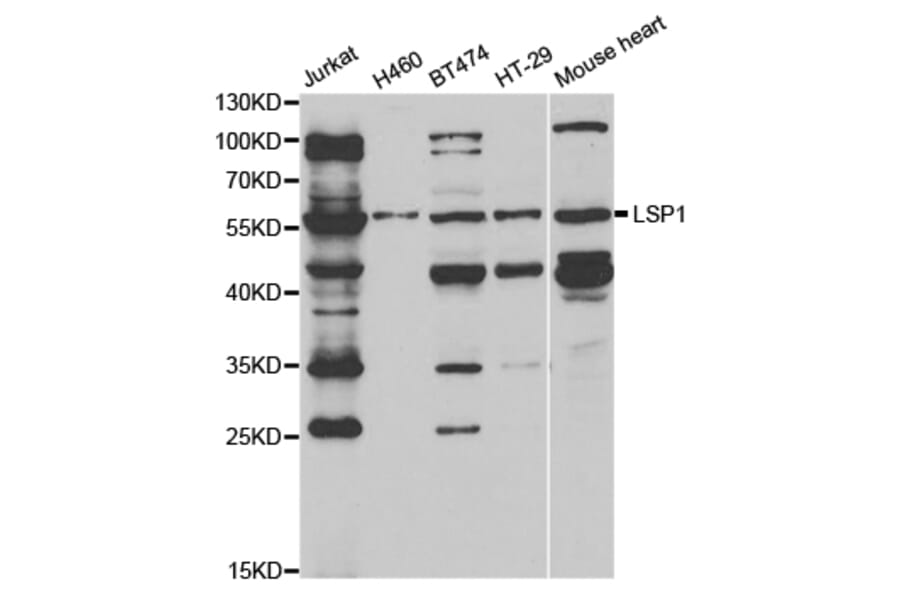 Western Blot - Anti-LSP1 Antibody (A13624) - Antibodies.com