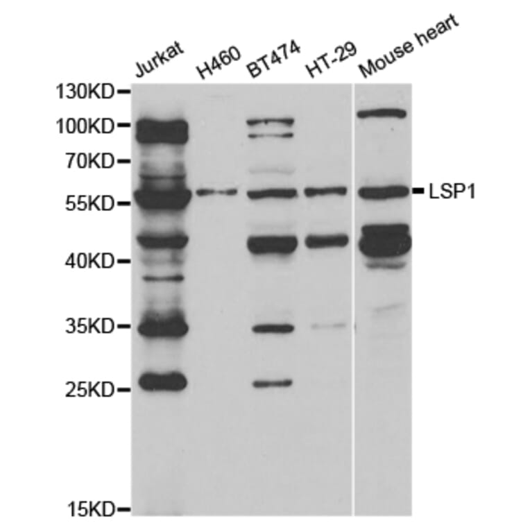 Western Blot - Anti-LSP1 Antibody (A13624) - Antibodies.com
