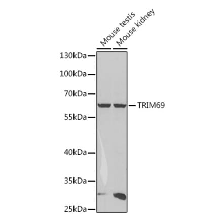 Western Blot - Anti-RNF36 Antibody (A90584) - Antibodies.com