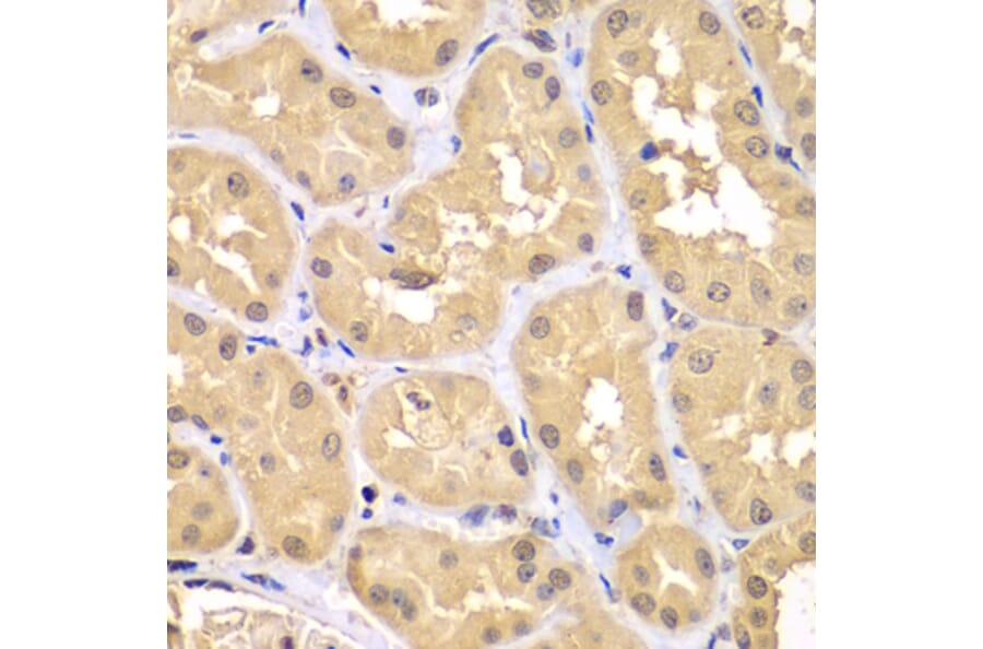Immunohistochemistry - Anti-RNF36 Antibody (A90584) - Antibodies.com