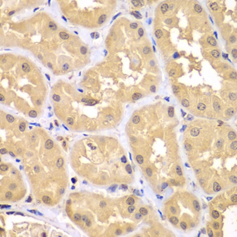 Immunohistochemistry - Anti-RNF36 Antibody (A90584) - Antibodies.com