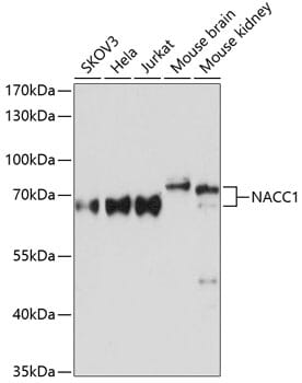 Western blot analysis of extracts of various cell lines, using Anti-NACC1 Antibody (A11720) at 1:3000 dilution.
Secondary antibody: Goat Anti-Rabbit IgG (H+L) (HRP) (AS014) at 1:10,000 dilution.
Lysates / proteins: 25µg per lane.
Blocking buffer: 3% non-fat dry milk in TBST.
Detection: ECL Basic Kit (RM00020).
Exposure time: 10s.