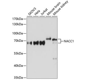 Western Blot - Anti-Nac1 Antibody (A90585) - Antibodies.com