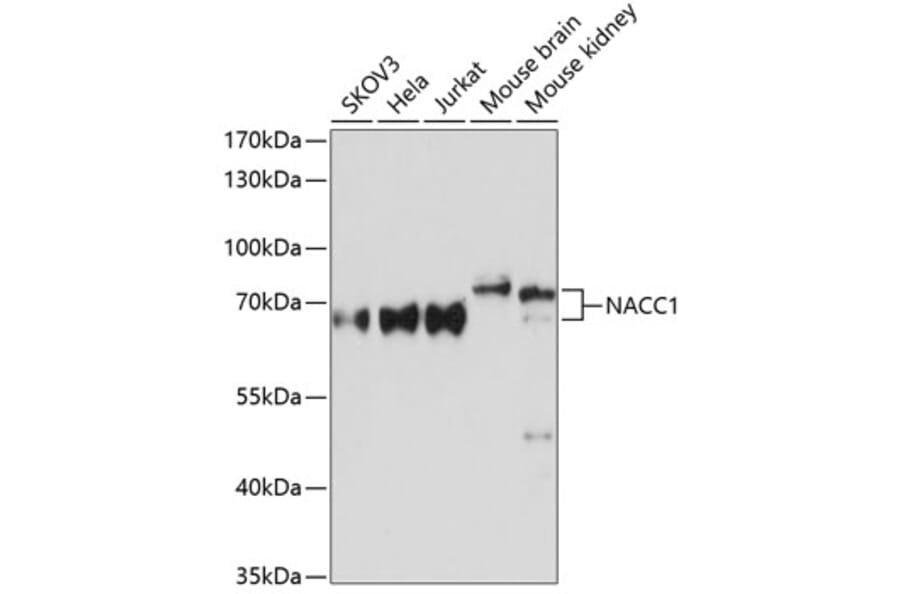 Western Blot - Anti-Nac1 Antibody (A90585) - Antibodies.com