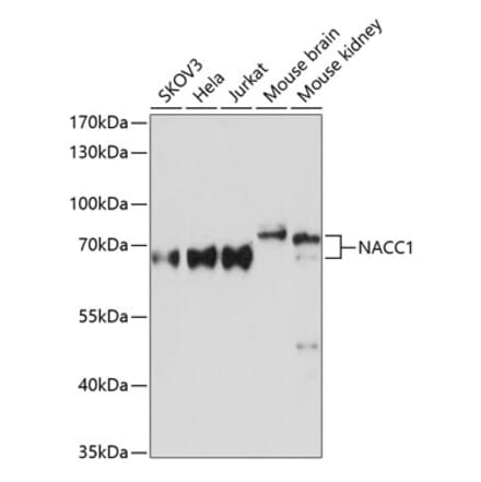 Western Blot - Anti-Nac1 Antibody (A90585) - Antibodies.com