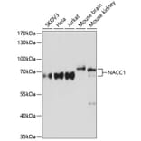 Western Blot - Anti-Nac1 Antibody (A90585) - Antibodies.com