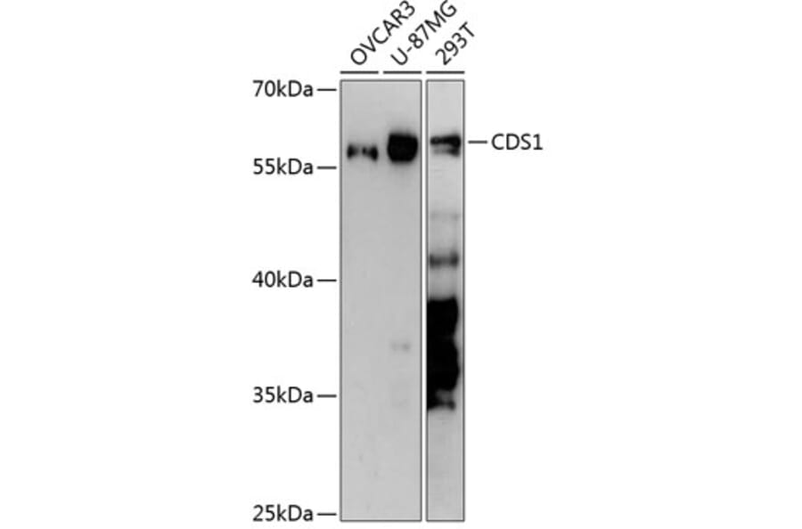 Western Blot - Anti-CDS1 Antibody (A90586) - Antibodies.com