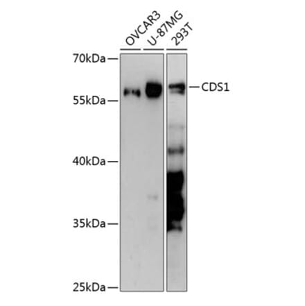 Western Blot - Anti-CDS1 Antibody (A90586) - Antibodies.com