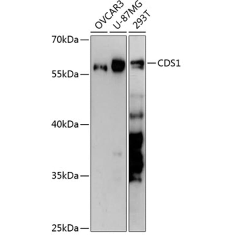 Western Blot - Anti-CDS1 Antibody (A90586) - Antibodies.com