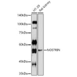 Western Blot - Anti-NOSTRIN Antibody (A90587) - Antibodies.com