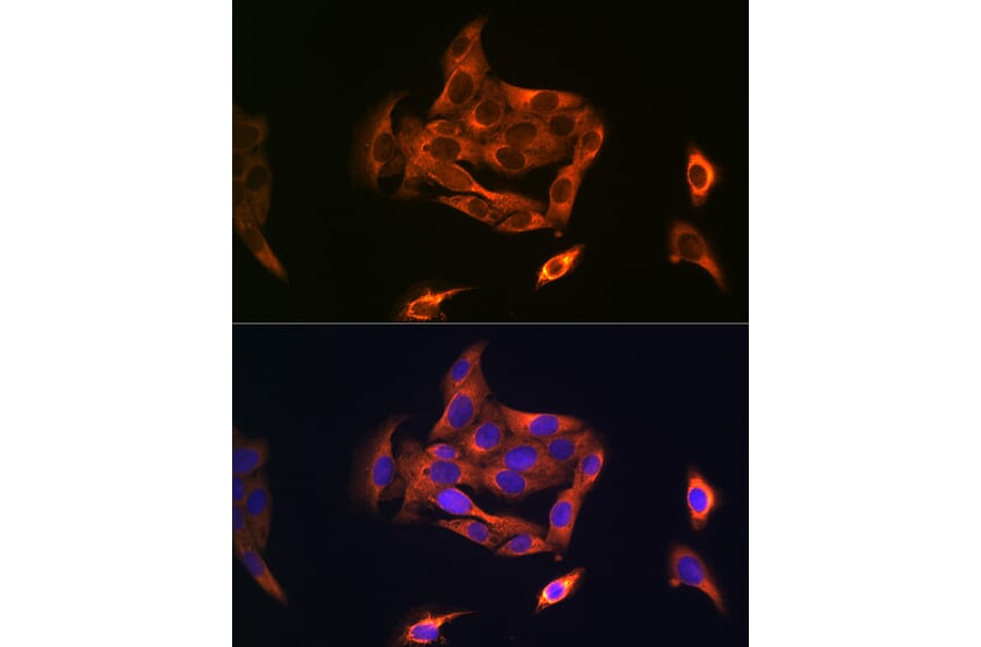 Immunofluorescence - Anti-NOSTRIN Antibody (A90587) - Antibodies.com