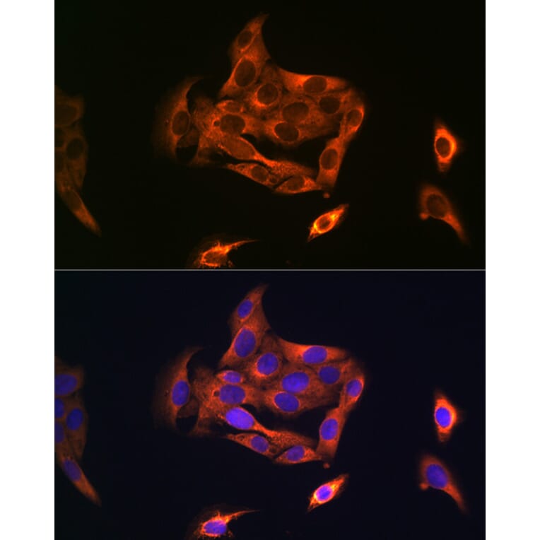 Immunofluorescence - Anti-NOSTRIN Antibody (A90587) - Antibodies.com