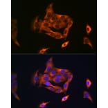 Immunofluorescence - Anti-NOSTRIN Antibody (A90587) - Antibodies.com