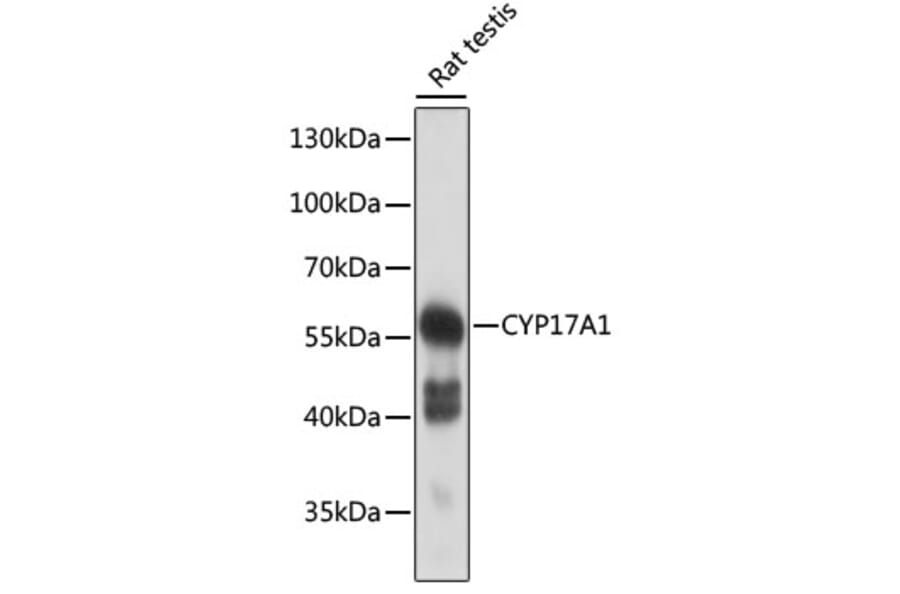 Western Blot - Anti-Cytochrome P450 17A1/CYP17A1 Antibody (A90588) - Antibodies.com