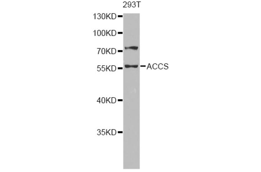 Western Blot - Anti-ACCS Antibody (A13441) - Antibodies.com