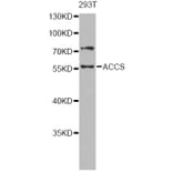 Western Blot - Anti-ACCS Antibody (A13441) - Antibodies.com
