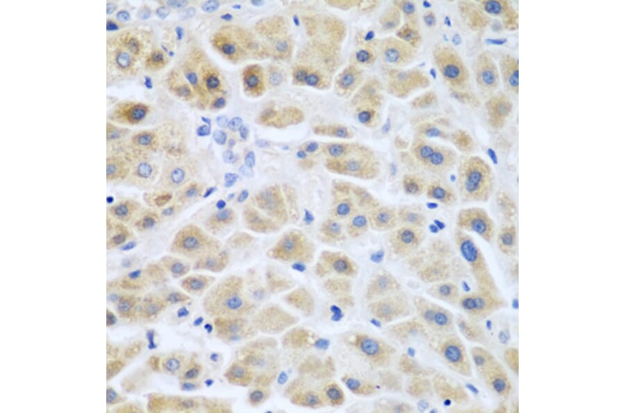 Immunohistochemistry - Anti-ACCS Antibody (A13441) - Antibodies.com