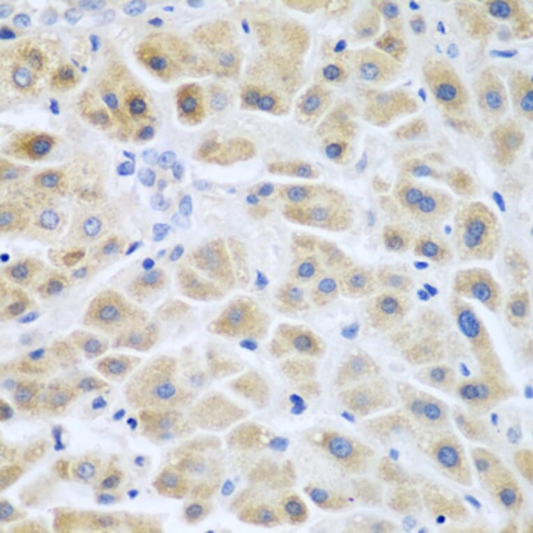 Immunohistochemistry - Anti-ACCS Antibody (A13441) - Antibodies.com