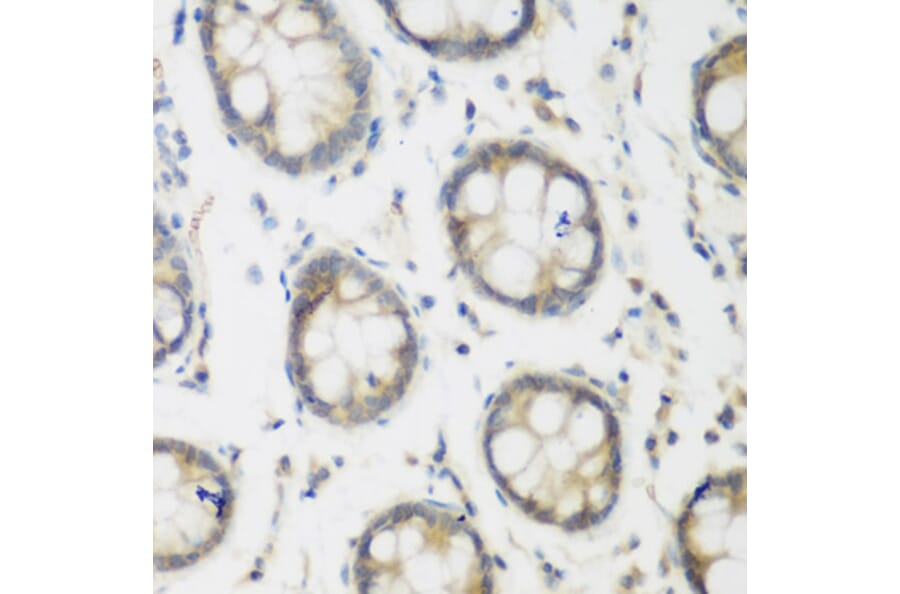 Immunohistochemistry - Anti-ACCS Antibody (A13441) - Antibodies.com