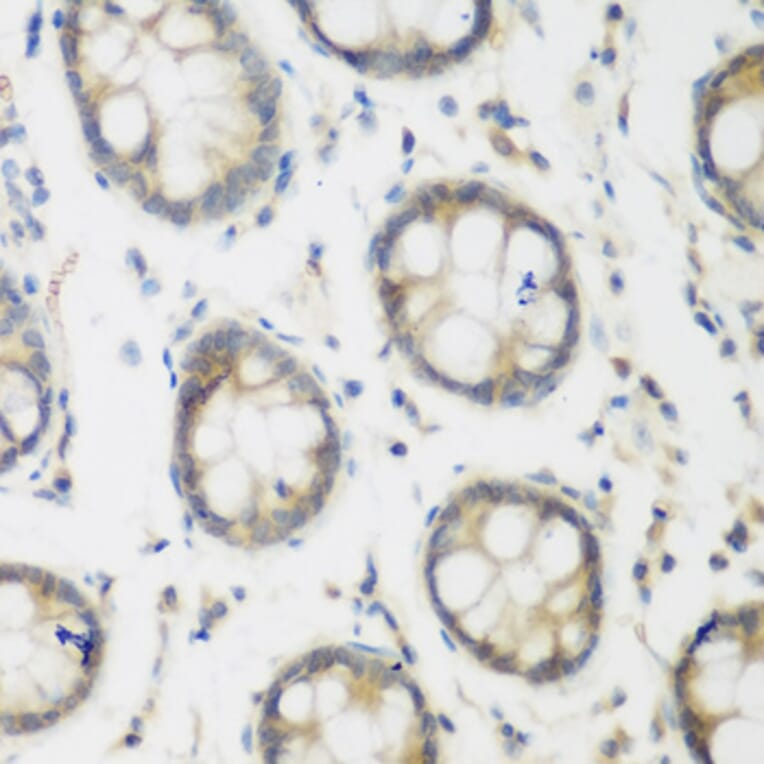 Immunohistochemistry - Anti-ACCS Antibody (A13441) - Antibodies.com