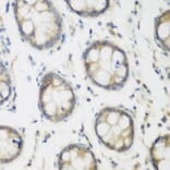 Immunohistochemistry - Anti-ACCS Antibody (A13441) - Antibodies.com