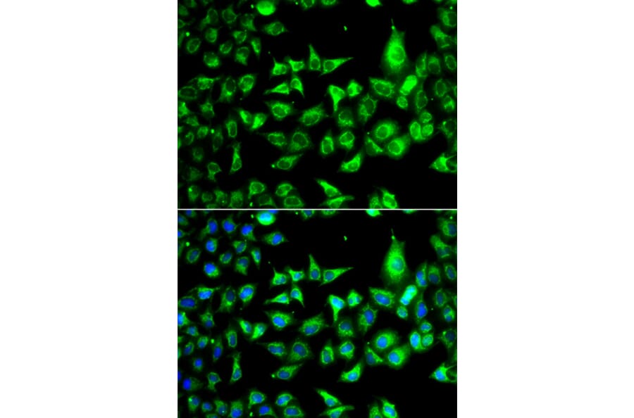 Immunofluorescence - Anti-ACCS Antibody (A13441) - Antibodies.com