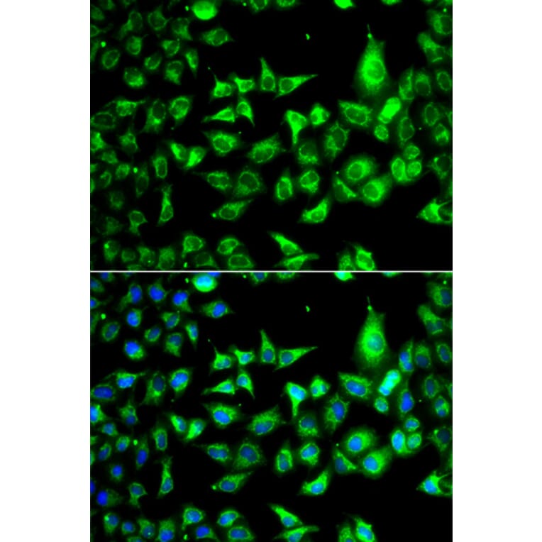 Immunofluorescence - Anti-ACCS Antibody (A13441) - Antibodies.com