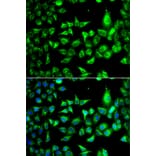 Immunofluorescence - Anti-ACCS Antibody (A13441) - Antibodies.com