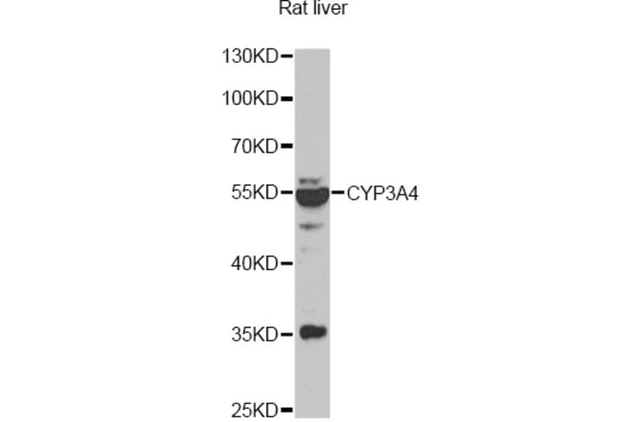 Western Blot - Anti-CYP3A4 Antibody (A13483) - Antibodies.com