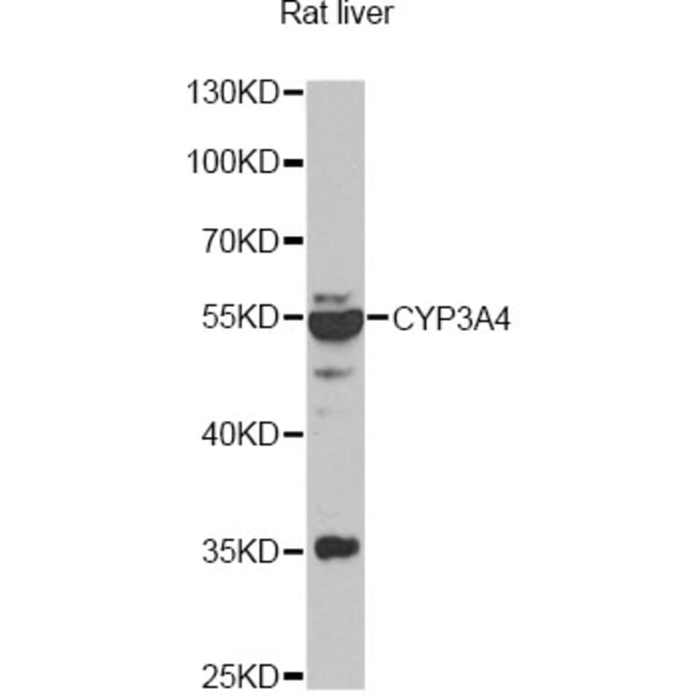 Western Blot - Anti-CYP3A4 Antibody (A13483) - Antibodies.com