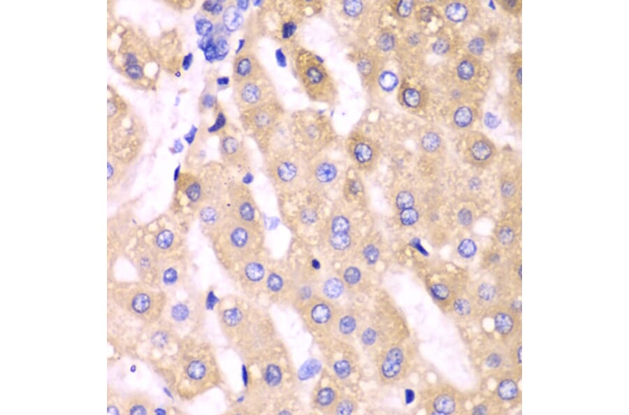 Immunohistochemistry - Anti-CYP3A4 Antibody (A13483) - Antibodies.com