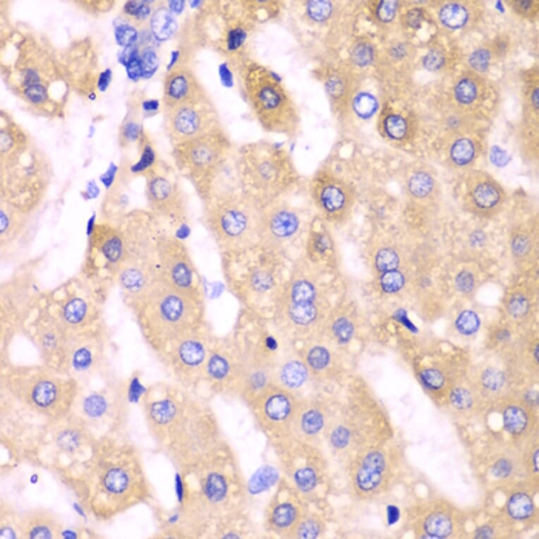 Immunohistochemistry - Anti-CYP3A4 Antibody (A13483) - Antibodies.com