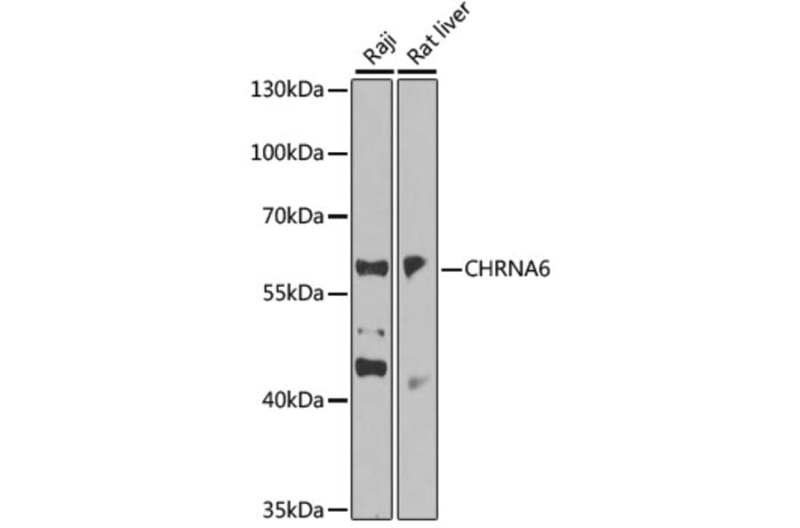 Western Blot - Anti-CHRNA6 Antibody (A14081) - Antibodies.com