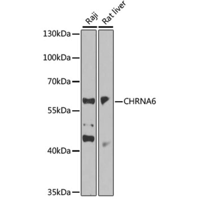 Western Blot - Anti-CHRNA6 Antibody (A14081) - Antibodies.com