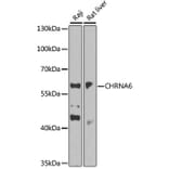 Western Blot - Anti-CHRNA6 Antibody (A14081) - Antibodies.com