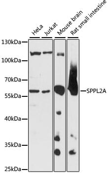 Western blot analysis of extracts of various cell lines, using Anti-SPPL2A Antibody (A15539) at 1:1,000 dilution.
Secondary antibody: Goat Anti-Rabbit IgG (H+L) (HRP) (AS014) at 1:10,000 dilution.
Lysates / proteins: 25µg per lane.
Blocking buffer: 3% non-fat dry milk in TBST.
Detection: ECL Basic Kit (RM00020).
Exposure time: 5s.