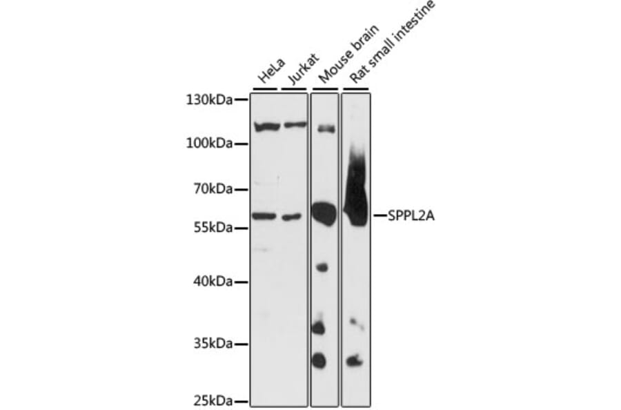 Western Blot - Anti-SPPL2a Antibody (A90593) - Antibodies.com