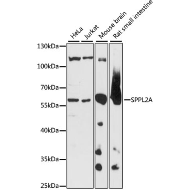 Western Blot - Anti-SPPL2a Antibody (A90593) - Antibodies.com