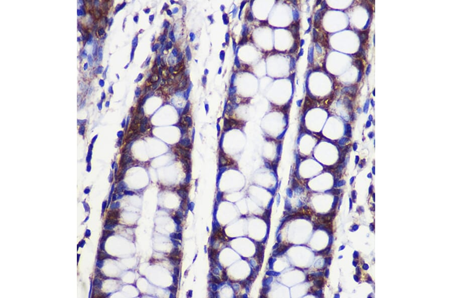 Immunohistochemistry - Anti-SPPL2a Antibody (A90593) - Antibodies.com