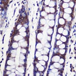 Immunohistochemistry - Anti-SPPL2a Antibody (A90593) - Antibodies.com