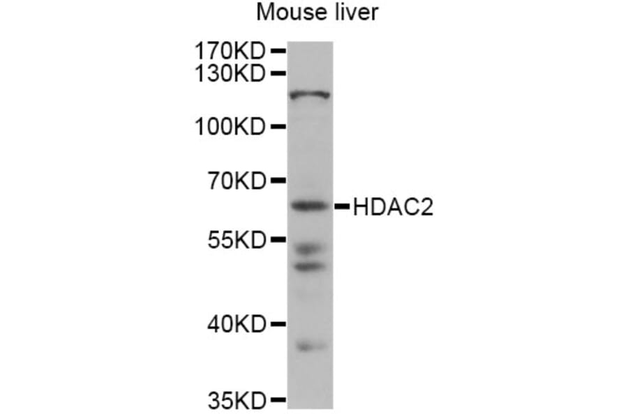 Western Blot - Anti-HDAC2 Antibody (A13618) - Antibodies.com