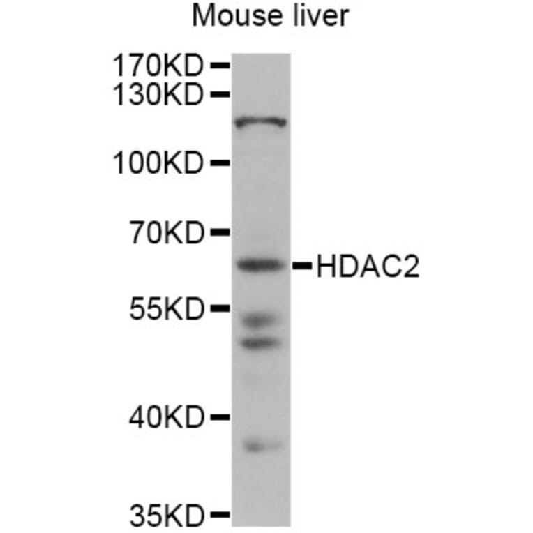 Western Blot - Anti-HDAC2 Antibody (A13618) - Antibodies.com