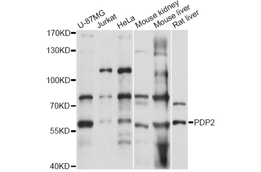 Western Blot - Anti-PDP2 Antibody (A14416) - Antibodies.com