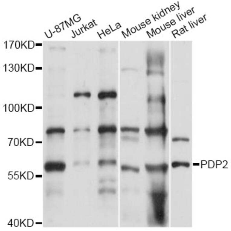 Western Blot - Anti-PDP2 Antibody (A14416) - Antibodies.com